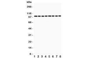 Western Blotting (WB) image for anti-Metadherin (MTDH) (AA 101-270) antibody (ABIN3031760)