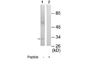 Image no. 1 for anti-MAX-Like Protein X (MLX) antibody (ABIN272258) (MLX 抗体)