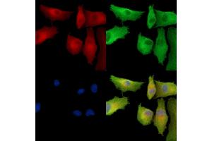 ABIN7096894 and ABIN7100960 staining  cells by IF/ICC.