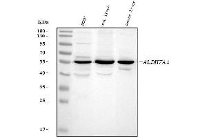 Western blot analysis of ALDH7A1 using anti-ALDH7A1 antibody (ABIN4886452).