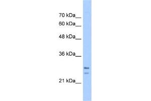 WB Suggested Anti-SRPRB Antibody Titration:  5. (SRPRB 抗体  (C-Term))
