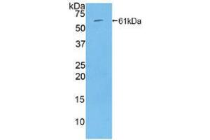 Western blot analysis of recombinant Rat THBS4. (THBS4 抗体  (AA 708-963))