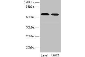 Western blot All lanes: Hmgcs1 antibody at 12 μg/mL Lane 1: NIH/3T3 whole cell lysate Lane 2: Mouse liver tissue Secondary Goat polyclonal to rabbit IgG at 1/10000 dilution Predicted band size: 58 kDa Observed band size: 58 kDa (HMGCS1 抗体  (AA 1-520))
