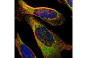 Immunofluorescent staining of human cell line U-2 OS with PFKM polyclonal antibody  under 1-4 ug/mL working concentration shows positivity in endoplasmic reticulum. (PFKM 抗体)