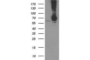 Western Blotting (WB) image for anti-Ribophorin 1 (RPN1) antibody (ABIN1500753) (RPN1 抗体)