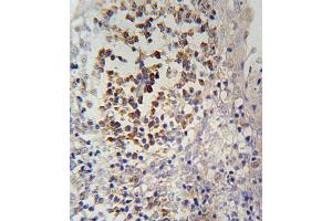 IL12RB2 Antibody (C-term) (ABIN654644 and ABIN2844340) immunohistochemistry analysis in formalin fixed and paraffin embedded human tonsils tissue followed by peroxidase conjugation of the secondary antibody and DAB staining. (IL12_2 (AA 756-783), (C-Term) 抗体)