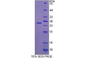 SDS-PAGE analysis of Rat Apolipoprotein B Protein. (APOB 蛋白)