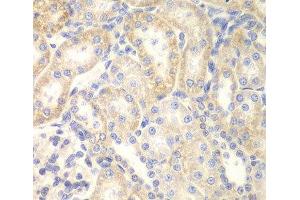 Immunohistochemistry of paraffin-embedded Rat kidney using DLC1 Polyclonal Antibody at dilution of 1:200 (40x lens). (DLC1 抗体)