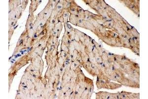 IHC testing of FFPE mouse heart with FXYD1 antibody.