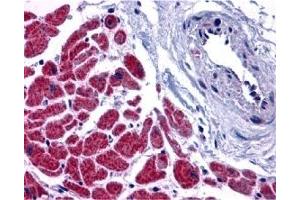 Immunohistochemistry (IHC) image for anti-Caspase 12 (Gene/pseudogene) (CASP12) (N-Term) antibody (ABIN1031295) (Caspase 12 抗体  (N-Term))