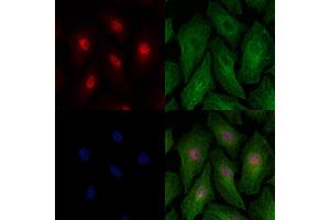 Phospho-IRF7 (Ser439) Antibody staining A549 cells(heat shock treatment) by IF/ICC. (IRF7 抗体  (pSer439))