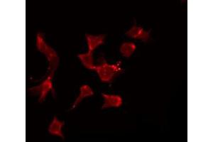 Immunofluorescence (fixed cells) (IF/ICC) image for anti-Tumor Necrosis Factor Receptor Superfamily, Member 17 (TNFRSF17) (Internal Region) antibody (ABIN6265641)