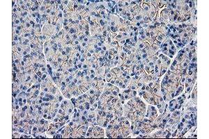 Immunohistochemical staining of paraffin-embedded Human pancreas tissue using anti-GUK1 mouse monoclonal antibody. (GUK1 抗体)