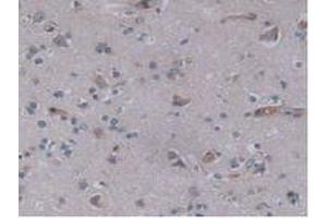 IHC-P analysis of Human Brain Tissue, with DAB staining. (JAG2 抗体  (AA 714-981))
