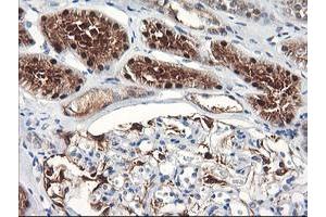 Immunohistochemical staining of paraffin-embedded Human Kidney tissue using anti-FBXO21 mouse monoclonal antibody. (FBXO21 抗体)