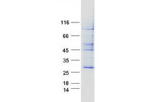 Validation with Western Blot