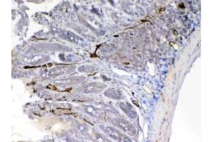 IHC analysis of Factor D using anti-Factor D antibody .