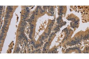 Immunohistochemistry (Paraffin-embedded Sections) (IHC (p)) image for anti-Potassium Voltage-Gated Channel, Shaker-Related Subfamily, Member 7 (KCNA7) antibody (ABIN7239125)
