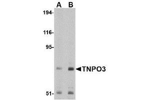 Image no. 1 for anti-Transportin 3 (TNPO3) (N-Term) antibody (ABIN1494359) (Transportin 3 抗体  (N-Term))