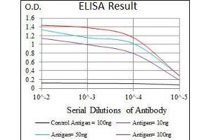 Black line: Control Antigen (100 ng), Purple line: Antigen(10 ng), Blue line: Antigen (50 ng), Red line: Antigen (100 ng), (Cytokeratin 13 抗体  (AA 143-295))