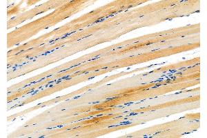 ABIN6261753 and ABIN6276862 at 1/100 staining Rat muscle tissue by IHC-P. (FKBP1A 抗体  (N-Term))
