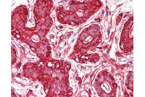 Anti-ACTG1 / Gamma Actin antibody IHC staining of human breast. (Actin, gamma 1 抗体  (N-Term))