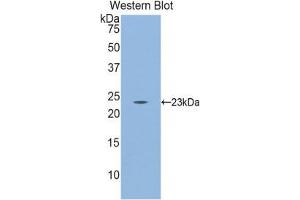 Western Blotting (WB) image for anti-CD8b Molecule (CD8B) (AA 21-208) antibody (ABIN1858317) (CD8B 抗体  (AA 21-208))