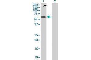 Western Blot analysis of NUP62 expression in transfected 293T cell line by NUP62 MaxPab polyclonal antibody. (NUP62 抗体  (AA 1-522))