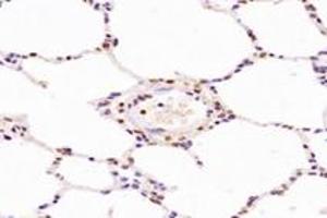 Immunohistochemistry (Paraffin-embedded Sections) (IHC (p)) image for anti-Non-SMC Condensin II Complex, Subunit G2 (NCAPG2) antibody (ABIN7074856)