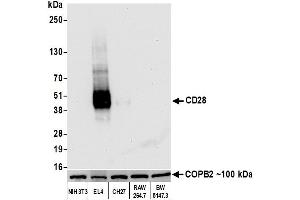 Western Blotting (WB) image for anti-CD28 (CD28) (AA 170-220) antibody (ABIN7455122) (Recombinant CD28 抗体  (AA 170-220))