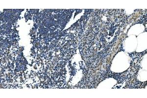 IHC analysis of LSM7 using anti-LSM7 antibody (ABIN7598937). (LSM7 抗体  (AA 1-103))