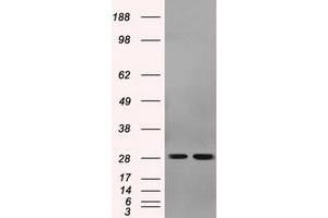 Image no. 2 for anti-Replication Protein A2, 32kDa (RPA2) antibody (ABIN1500733) (RPA2 抗体)