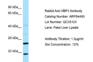 Western Blotting (WB) image for anti-Prefoldin Subunit 3 (PFDN3) (C-Term) antibody (ABIN2789852) (VBP1 抗体  (C-Term))