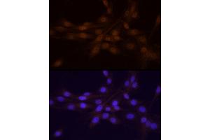 Immunofluorescence analysis of PC-12 cells using Chk1 Rabbit pAb (ABIN6134818, ABIN6138518, ABIN6138519 and ABIN6223572) at dilution of 1:25 (40x lens). (CHEK1 抗体)