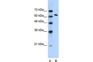 Western Blotting (WB) image for anti-FACT complex subunit SPT16 (SUPT16H) antibody (ABIN2460242) (SUPT16H 抗体)