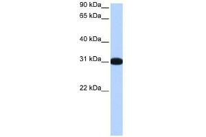 MBNL2 antibody used at 0. (MBNL2 抗体  (Middle Region))