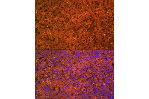 anti-Aldehyde Dehydrogenase 1 Family, Member L1 (ALDH1L1) antibody