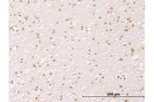 Immunoperoxidase of monoclonal antibody to MDM2 on formalin-fixed paraffin-embedded human cerebral cortex. (MDM2 抗体  (AA 101-200))