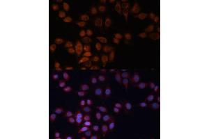 Immunofluorescence analysis of HeLa cells using  Polyclonal Antibody (ABIN6131157, ABIN6136523, ABIN6136524 and ABIN6223703) at dilution of 1:100 (40x lens). (ADAM15 抗体)