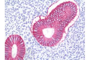 Anti-ESA / EPCAM antibody IHC staining of human uterus, endometrium. (EpCAM 抗体)