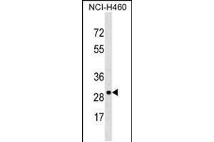 Western blot analysis in NCI-H460 cell line lysates (35ug/lane). (VDAC3 抗体  (AA 156-183))