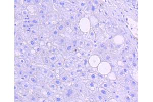 Immunohistochemistry of paraffin-embedded human liver using Phospho-JNK1/2/3-T183/T183/T221 antibody (abx125450) at dilution of 1/100 (40x lens). (SMAD2 抗体  (pThr183, pThr221))