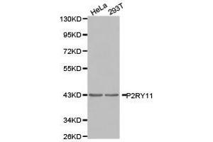 Western Blotting (WB) image for anti-Purinergic Receptor P2Y, G-Protein Coupled, 11 (P2RY11) antibody (ABIN1874013) (P2RY11 抗体)