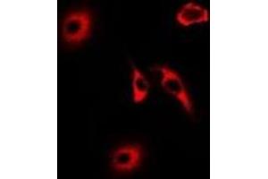 Immunofluorescent analysis of HNMT staining in U2OS cells. (HNMT 抗体)