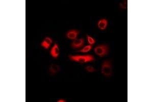Immunofluorescent analysis of ATR staining in Hela cells. (ATR 抗体)