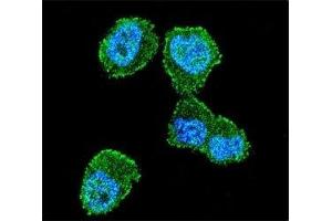 Confocal immunofluorescent analysis of LKB1 antibody with ZR-75-1 cells followed by Alexa Fluor 488-conjugated goat anti-rabbit lgG (green). (LKB1 抗体  (AA 19-48))