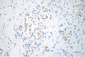 anti-Pancreatic and Duodenal Homeobox 1 (PDX1) antibody