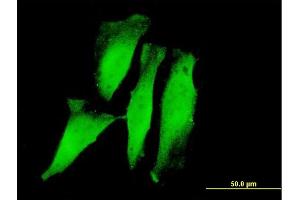 Immunofluorescence of monoclonal antibody to RNF11 on HeLa cell. (RNF11 抗体  (AA 65-154))