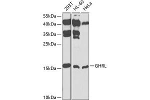Western blot analysis of extracts of various cell lines, using GHRL antibody (ABIN3021900, ABIN3021901, ABIN3021902 and ABIN6217352) at 1:1000 dilution. (Ghrelin 抗体  (AA 1-117))