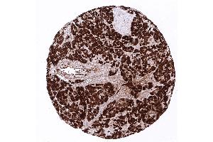 pancreas (CPA1 抗体)